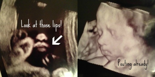 ultrasound28 weeks